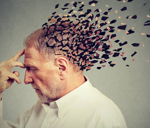 alzheimers-mans-head