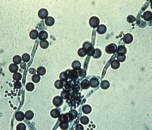 chlamydospores Candida albicans