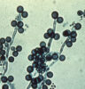 chlamydospores Candida albicans