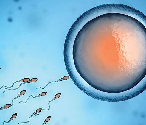 infertility