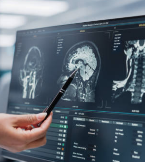 brain injuries scan