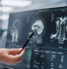 brain injuries scan